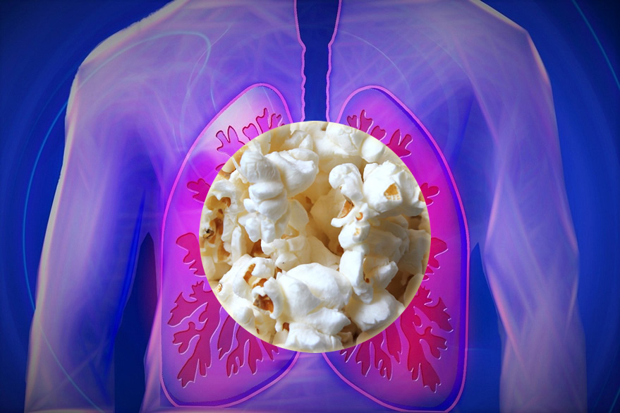 Popcorn lung Popcorn lung