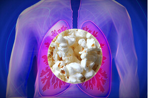 Popcorn lung