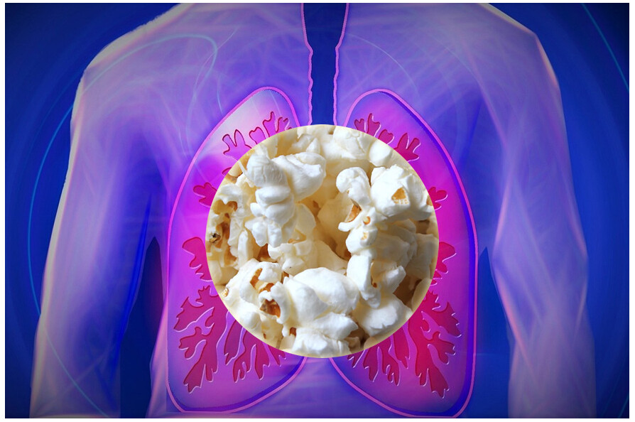 Popcorn lung