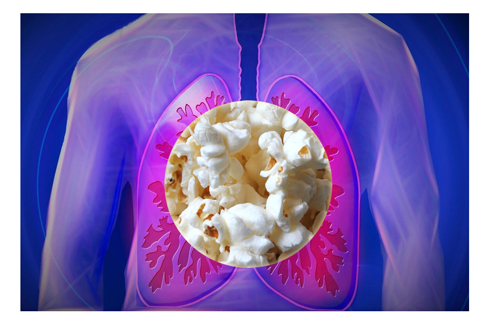 Popcorn lung